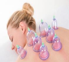 CUPPING